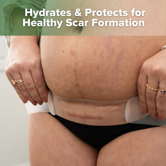 Haakaa Mum C-Section Scar Silicone Patches - 6pc (3 x 0.5mm + 3 x 1mm)