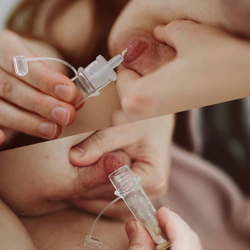 Early Expression of Colostrum in Pregnancy – A Pilot Study