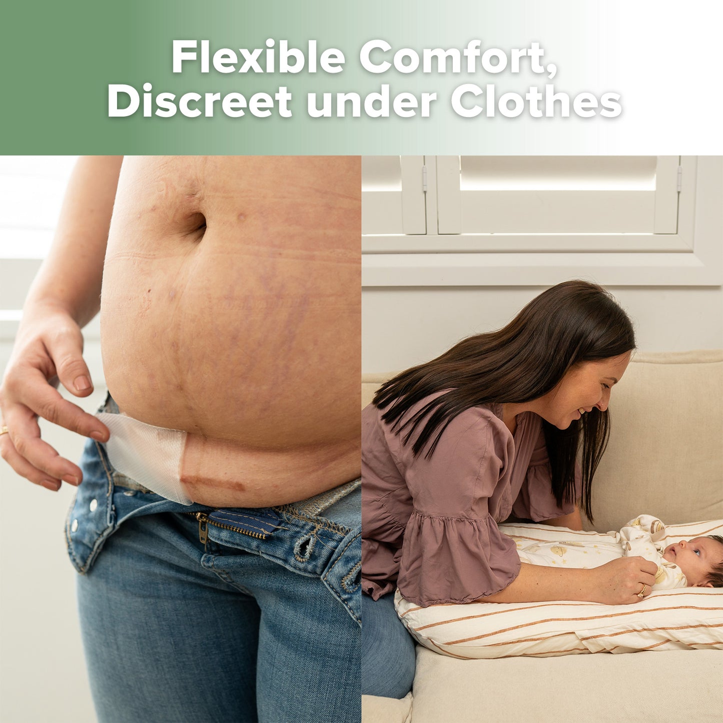 Haakaa Mum C-Section Scar Silicone Patches - 6pc (3 x 0.5mm + 3 x 1mm)